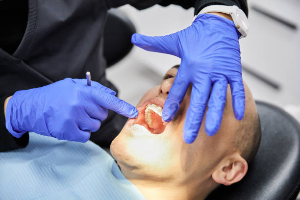 Best Emergency Dental Care for Broken or Chipped Teeth in Watkins Glen, NY